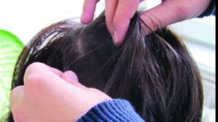 Focar de păduchi în şcoli: Cum prevenim transmiterea lor?