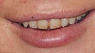 Află ingredientul secret care îți menține gingiile sănătoase