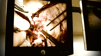 MINISTERUL SĂNĂTĂŢII - undă verde PRELEVĂRII de ORGANE fără acordul familiei. Care e condiţia