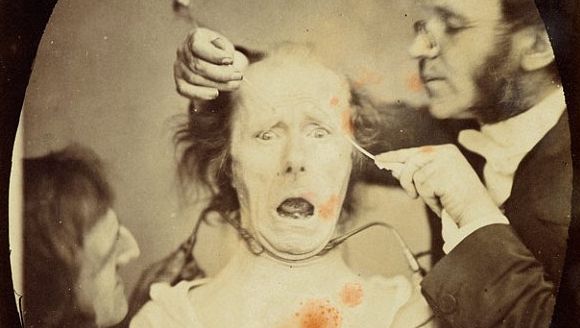 Ultimul experiment al lui Darwin: Fotografii tulburătoare din secolul XIX