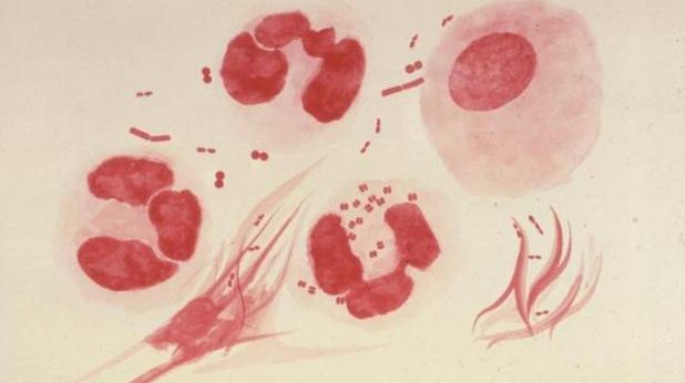 Această boală sexuală ar putea deveni în curând netratabilă