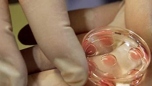 Dosarele pentru programul de fertilizare în vitro se depun de la 15 iunie. Ce condiţii sunt impuse