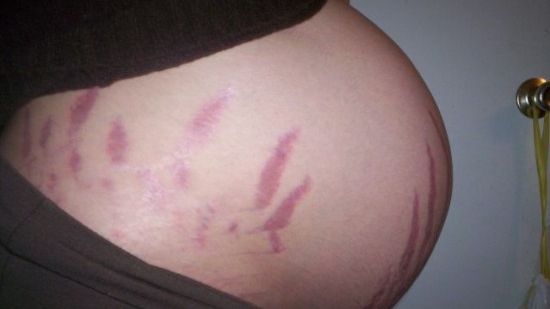 Imaginea BIZARĂ care a apărut pe ecografia unei viitoare mame. "E îngerul ei păzitor" - FOTO 