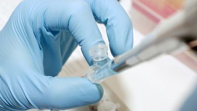 O infecție fungică MORTALĂ se răspândește în SUA! Avertismentul CDC: Nu răspunde la niciun medicament 