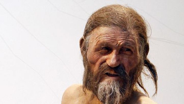 Otzi, omul ghețurilor, suferea de ateroscleroză