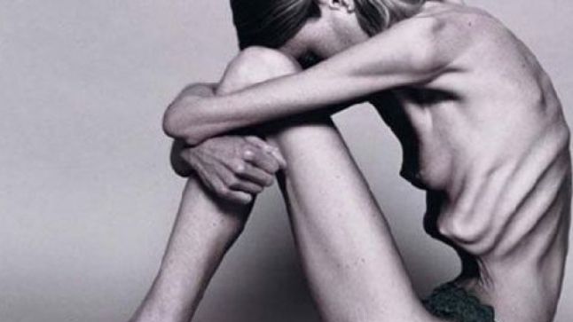Povestea dramatică a femeii de 47 de ani, care este anorexică şi vrea să fie ajutată să moară: "Fiecare zi este un iad"