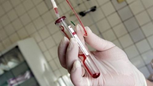 Metalele grele din sange care iti ameninta grav sanatatea