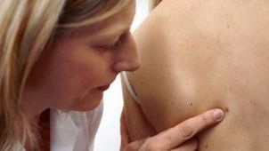 Cum recunoşti aluniţele periculoase