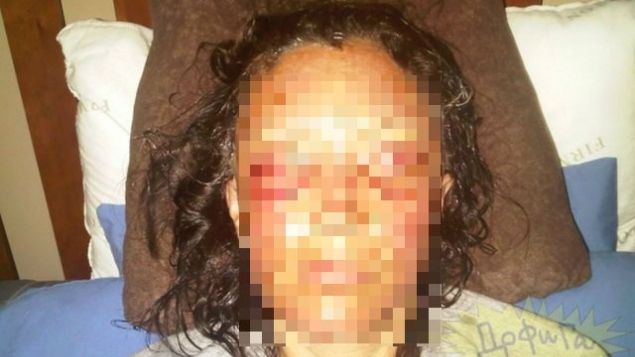 S-a dat cu o CREMĂ ANTIRID şi s-a culcat. Dimineaţă femeia a AVUT UN ŞOC 