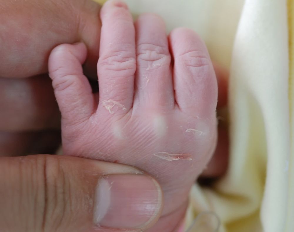 Naşterile prin cezariană nu vor mai fi decontate de stat 