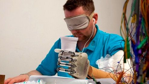 Are o mână bionică, dar simte tot ce atinge cu degetele