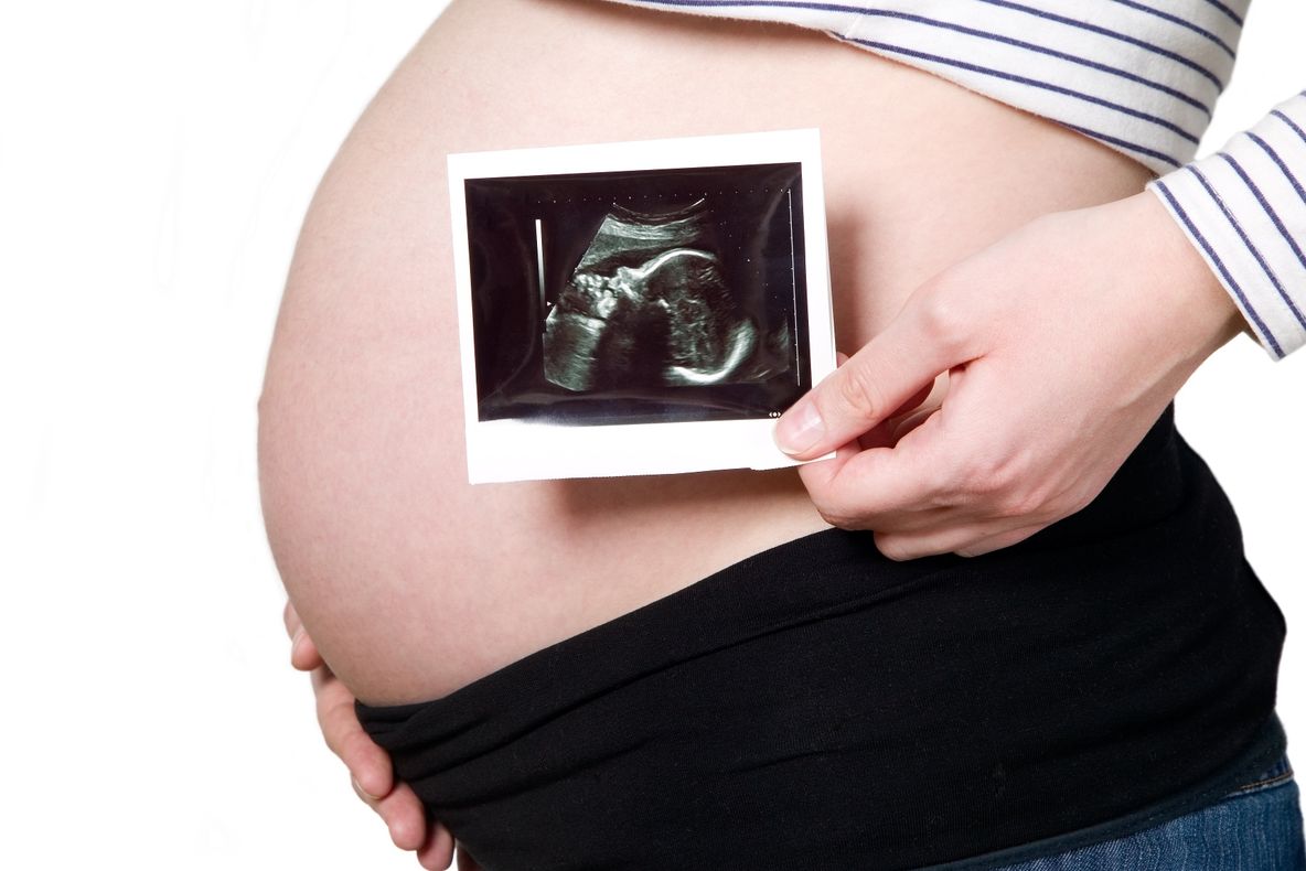 Premieră în România: O femeie a fost declarată mama naturală a copiilor născuţi de sora ei