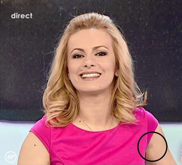 SIMONA GHERGHE, apariţie UIMITOARE în direct. Rochia i-a dezvăluit vânătăile