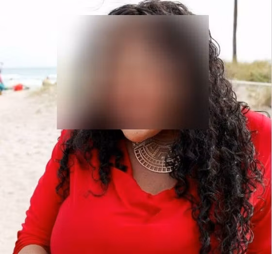 Cum arată femeia care şi-a injectat ciment şi lipici în faţă, pentru a fi ca "fetele din reviste"