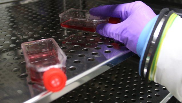 Un posibil caz de Ebola a fost înregistrat în Canada