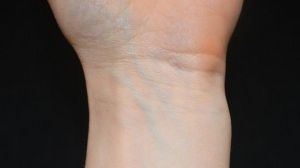 De ce sunt VENELE ALBASTRE. Explicaţia SIMPLĂ, dar ştiinţifică