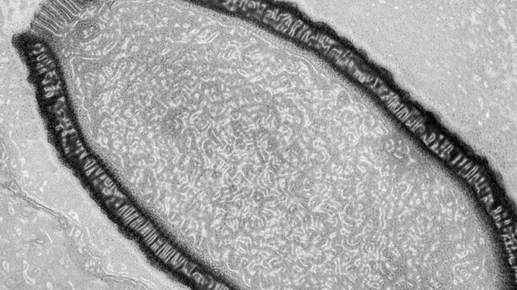 DESCOPERIREA care te va cutremura! Omenirea, în pericol din cauza unui tip de virus uriaş