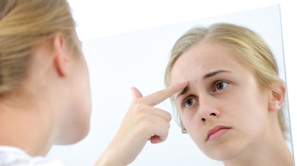 SĂNĂTATE. Tratament miraculos pentru acnee