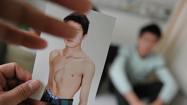 Cazul care I-A CUTREMURAT pe medici