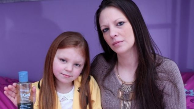 Ea e fetița care nu se poate SPĂLA. Explicația este uluitoare 