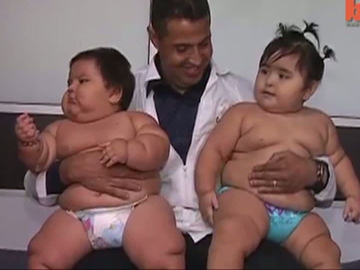 BEBELUŞII care au ŞOCAT medicii: cântăresc peste 20 de kg, la doar 10 luni
