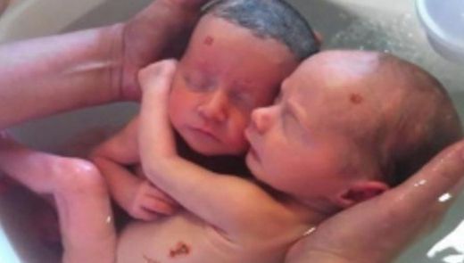 Avertisment CRUNT: S-au născut gemenii cu simbolurile Apocalipsei. Sfârșitul lumii este aproape