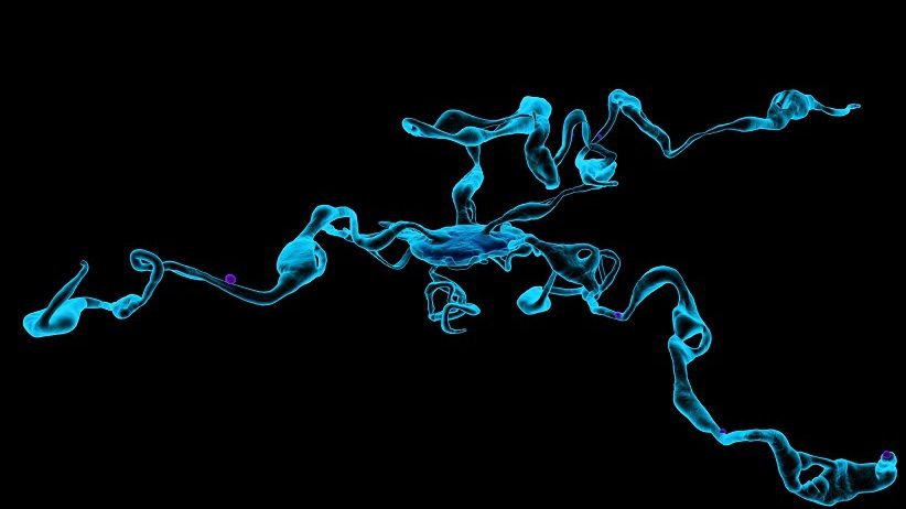 CELULELE CARE VINDECĂ CIROZA. Descoperire revoluţionară a cercetătorilor români