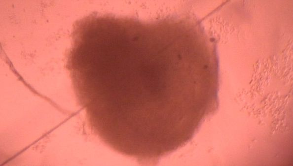 INIMI UMANE MINIATURALE, create în laborator de cercetătorii scoţieni