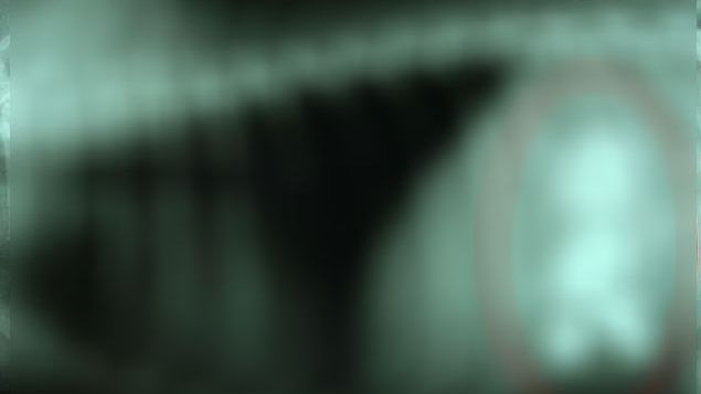 Medicii au înghețat când au descoperit asta în burta sa