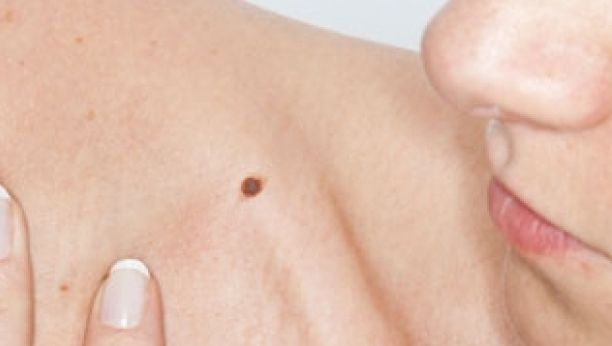 AFECŢIUNEA aparent BANALĂ despre care MEDICII SPUN CĂ ESTE O BOALĂ MORTALĂ