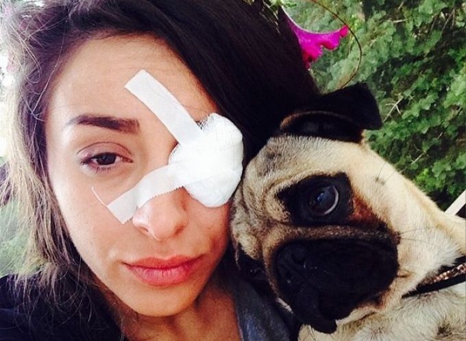 Ruby, după ACCIDENTUL GROAZNIC: "Mi-am pus OCHIUL DE STICLĂ" . VEZI CUM ARATĂ vedeta 