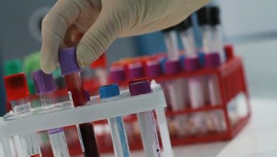 NOI STENOGRAME ŞOCANTE în scandalul traficului cu sânge: "Lasă, că nu-i trebuie la 14 ani sânge"