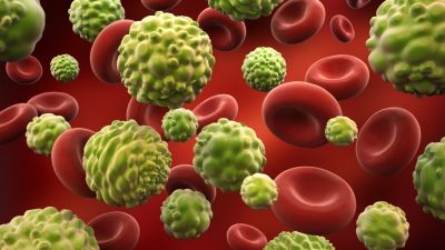 La ce formă de cancer eşti predispus, în funcţie de grupa de sânge