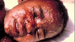 Boala care face ravagii în Africa și dă fiori Europei. E EPIDEMIE!