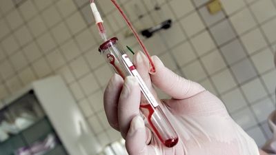 MALADIA TĂCUTĂ care face ravagii în România. Se transmite prin fluidele corporale, dar şi prin sânge