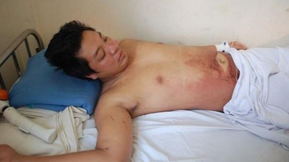 Trăieşte după ce a stat 103 ore în congelator