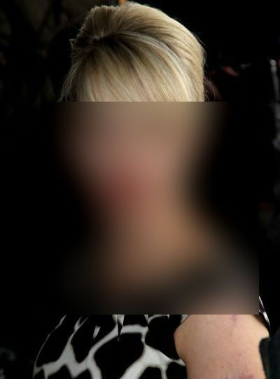 CUTREMURĂTOR. O vedetă a fost desfigurată cu acid sulfuric! Imagini