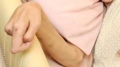 CUTREMURĂTOR: Cum arată femeia care a ajuns să bea 40 de doze de bere pe zi!