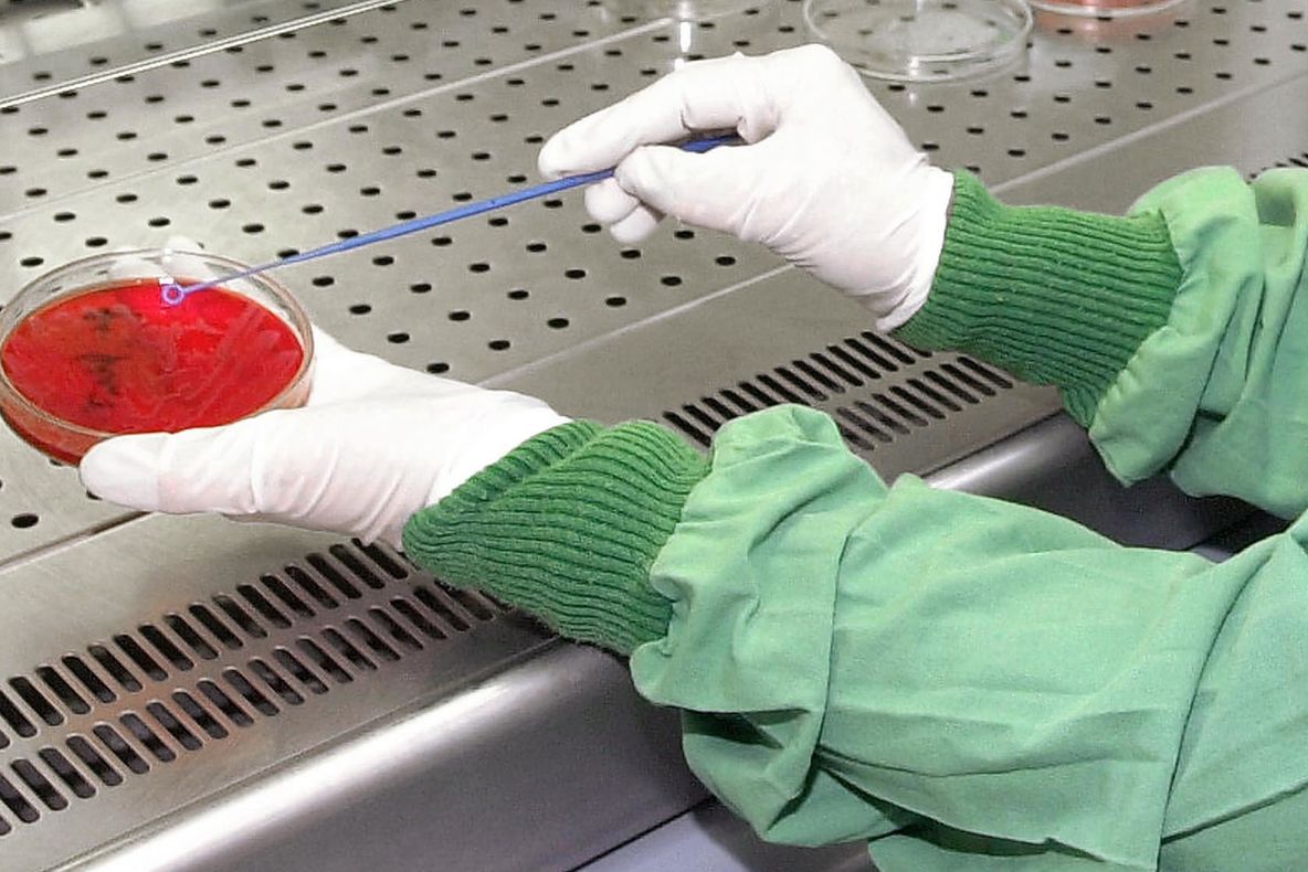 ALERTĂ SANITARĂ în România. Bărbat suspect de ANTRAX, internat în spital. De unde a luat virusul