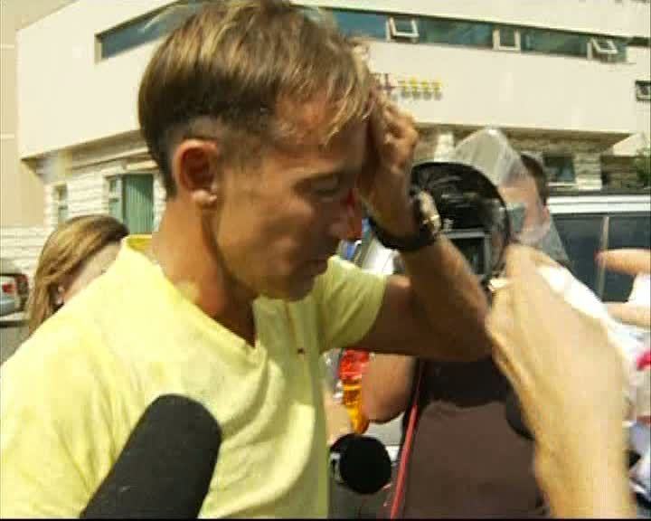 RADU MAZĂRE, implicat într-un accident. Primarul, plin de sânge pe față 