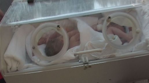 Veste de ultimă oră despre siamezele operate săptămâna trecută