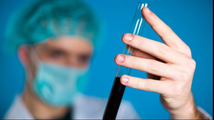 Persoanele cu grupa sangvină AB ar putea suferi de probleme de memorie la bătrâneţe