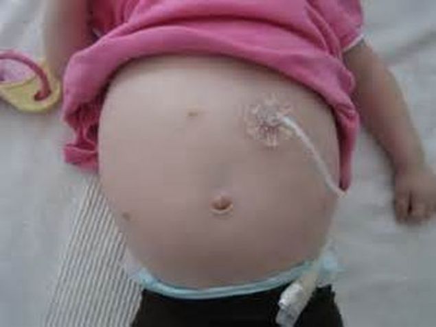 Se plangea de dureri de burta! Medicii, SOCATI de ce i-au gasit in stomac: Asa ceva nu am mai vazut