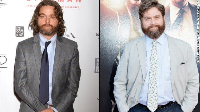 Alan, din "Marea Mahmureală", este de nerecunoscut. A slăbit aproape 20 de kg 