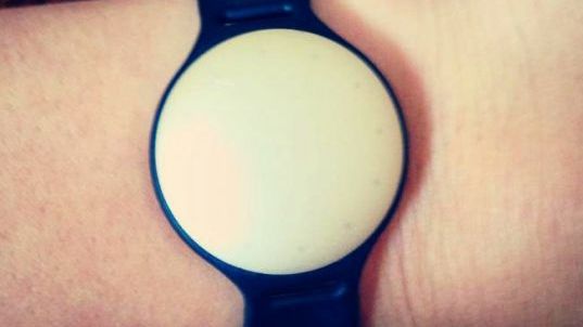 A slăbit incredibil de mult cu ajutorul unei brățări minune 