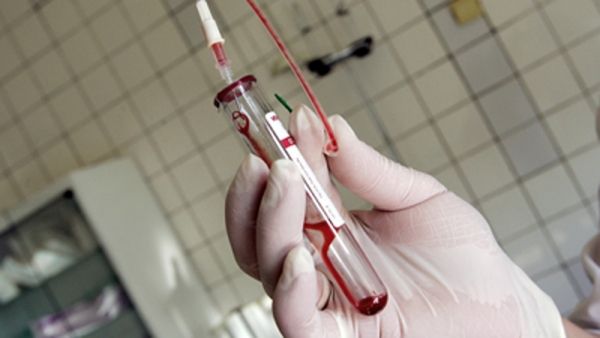 FOCAR de Hepatita A la COPII. 22 de cazuri doar într-o localitate