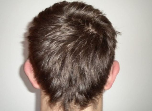 "Auzeam zgomote şi simţeam mişcări în pielea din spatele capului". E ŞOCANT ce i-au găsit medicii 