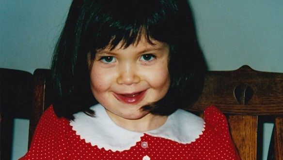 ŞOCANT! Li s-a spus că fetiţa lor suferă de pojar, însa S-AU ÎNGROZIT când au aflat ce are sub piele