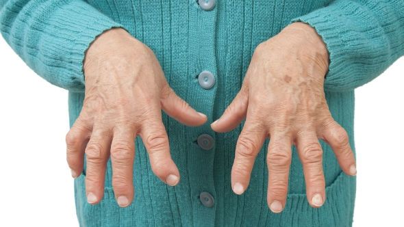 VIAŢA CU POLIARTRITĂ: Peste 200.000 de români suferă de această boală