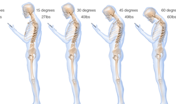 Avertizare! Telefonul mobil îţi deformează COLOANA